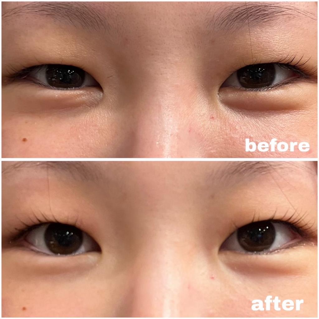 アトリエシャルムのまつ毛パーマ